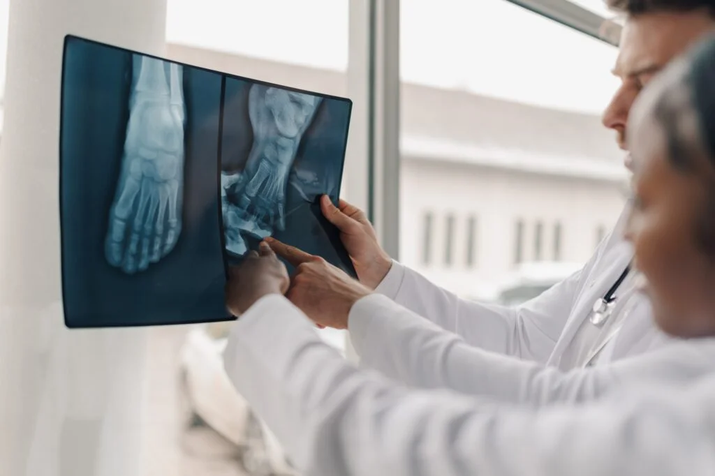 Doctors reviewing foot X-ray images together