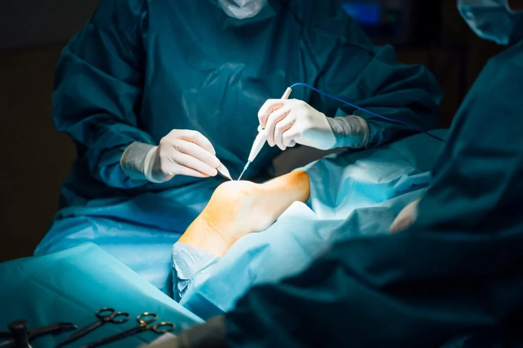 Surgeon performing minimally invasive foot procedure