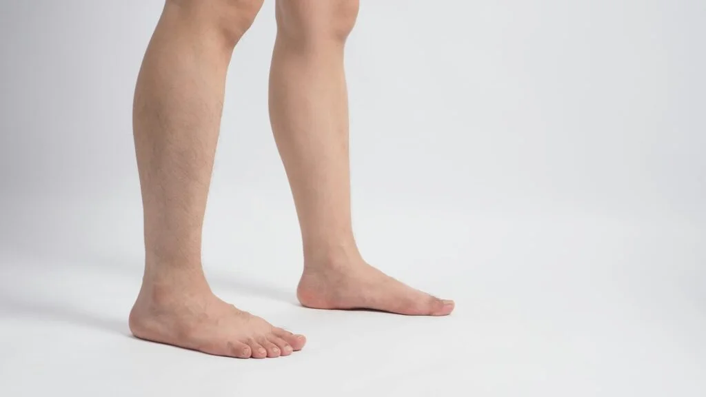 Side view of foot showing flat arch