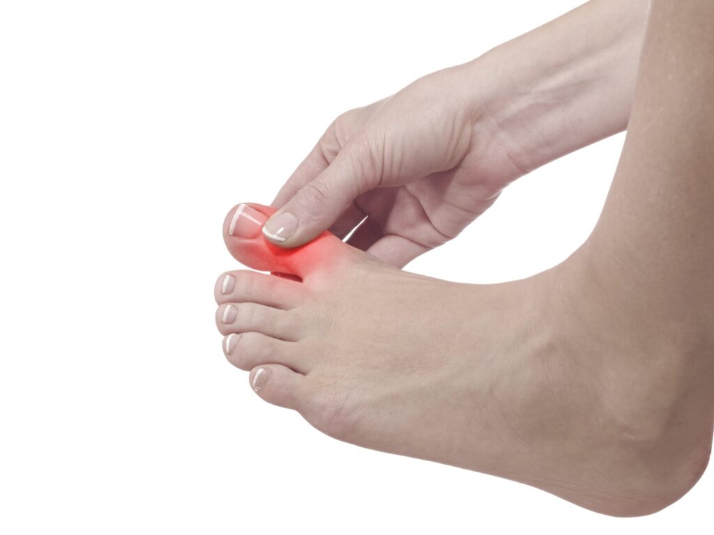 Hand touching inflamed big toe joint