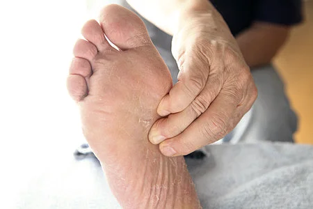 Hand pressing on foot's high arch area