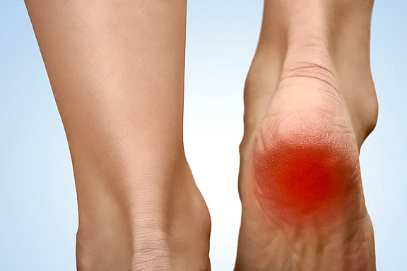 Heel highlighted in red showing pain area