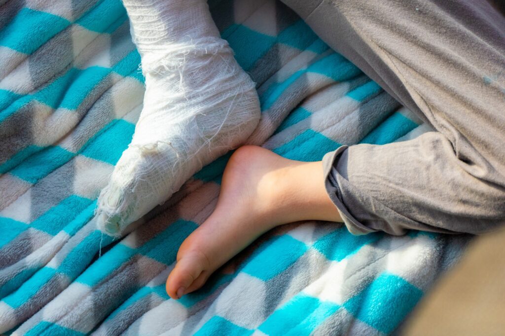 Child's foot in cast resting on blanket